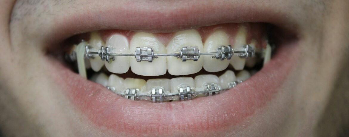 Orthodontie