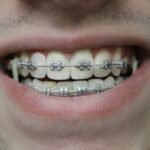 Orthodontie