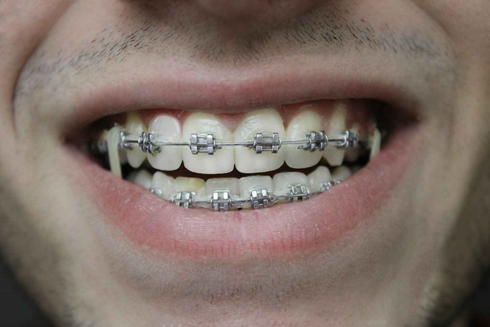 Orthodontie