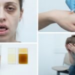 symptômes déshydratation